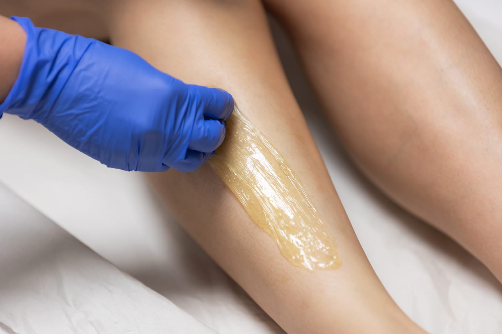Vartalo – SH Esthetics Oulu