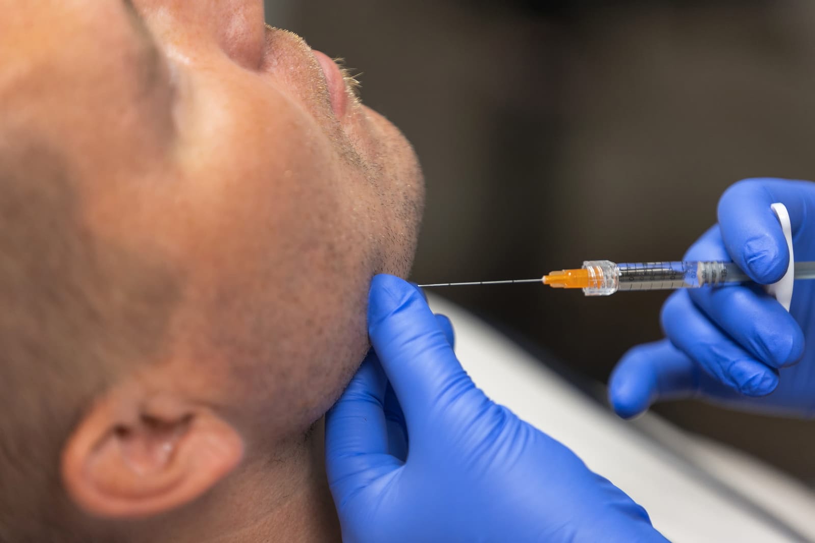 Radiesse – SH Esthetics Oulu