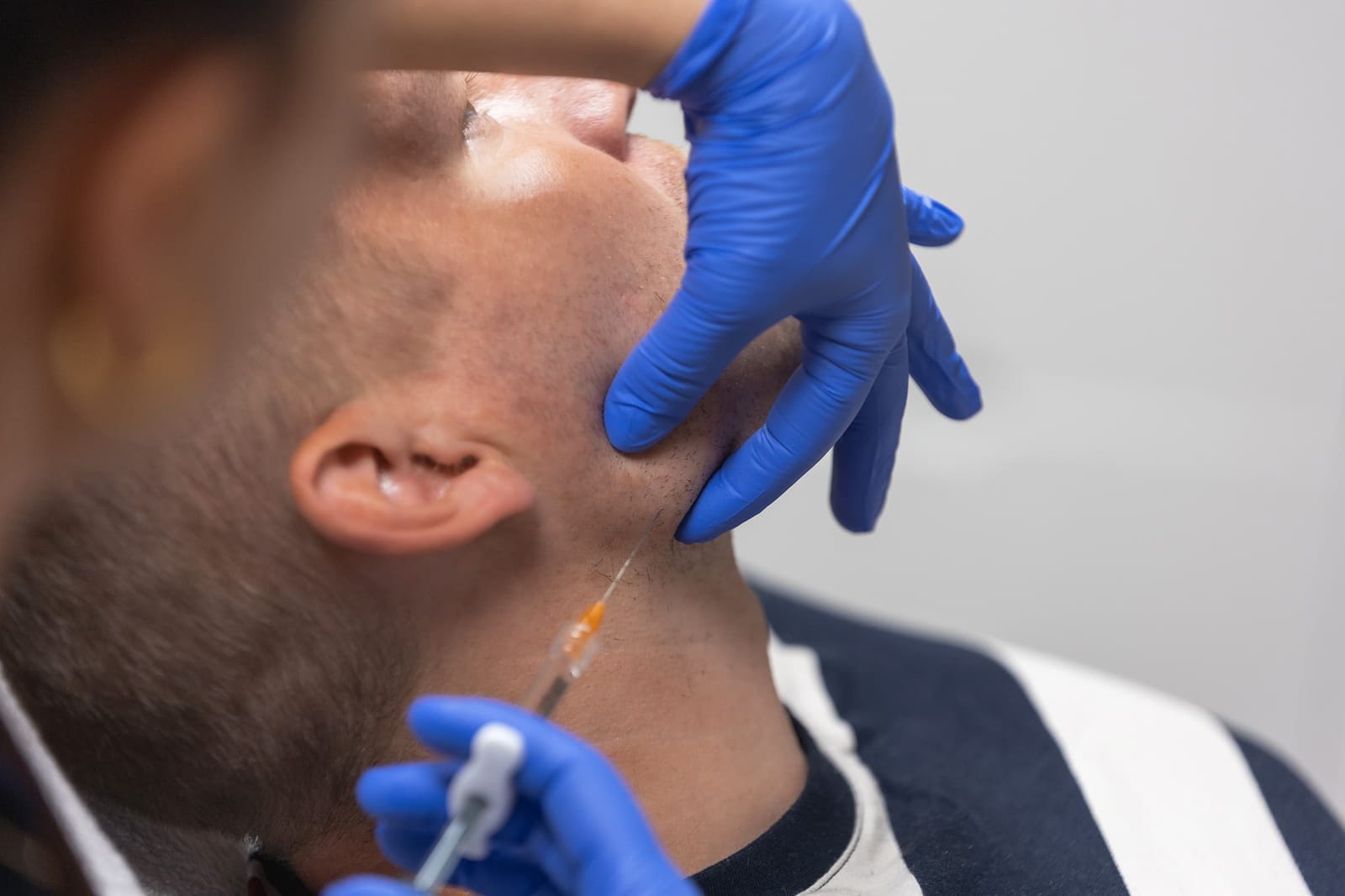 Tummat silmänaluset – SH Esthetics Oulu